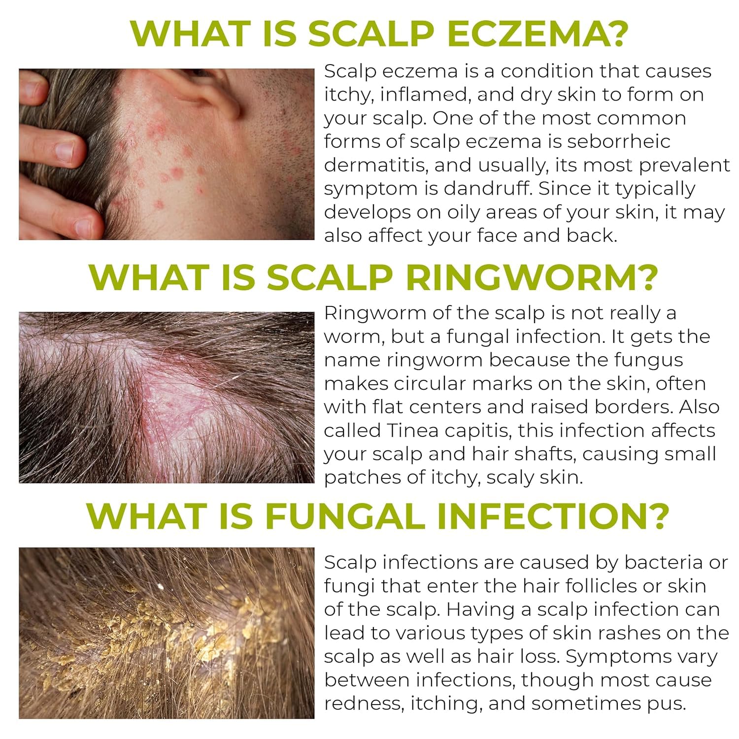 Rida Hair Research Institute Folliculitis scalp application demonstrating soothing relief potential