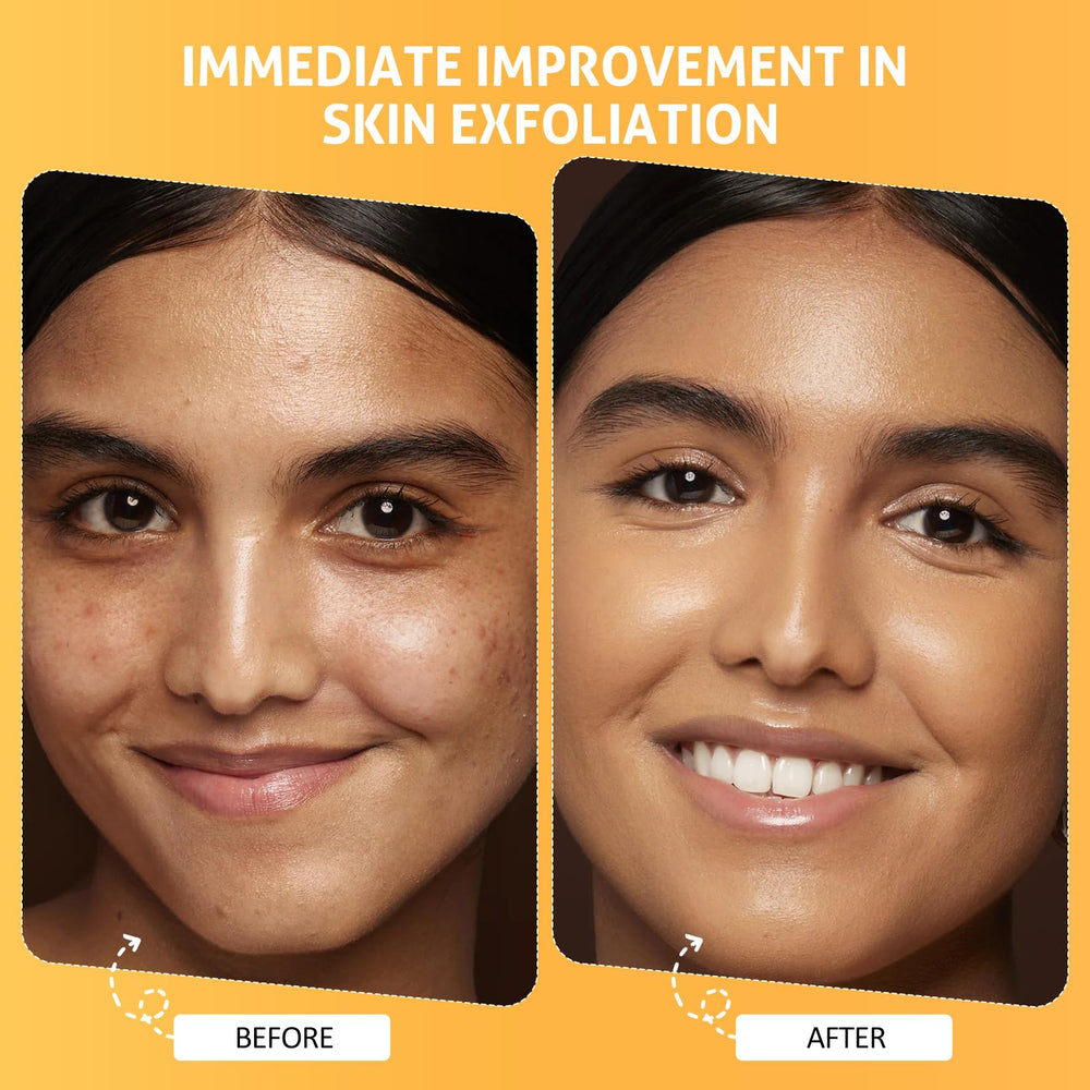 RIHAKO Pumpkin Enzyme Mask pores close-up, hinting at clarity and refined texture