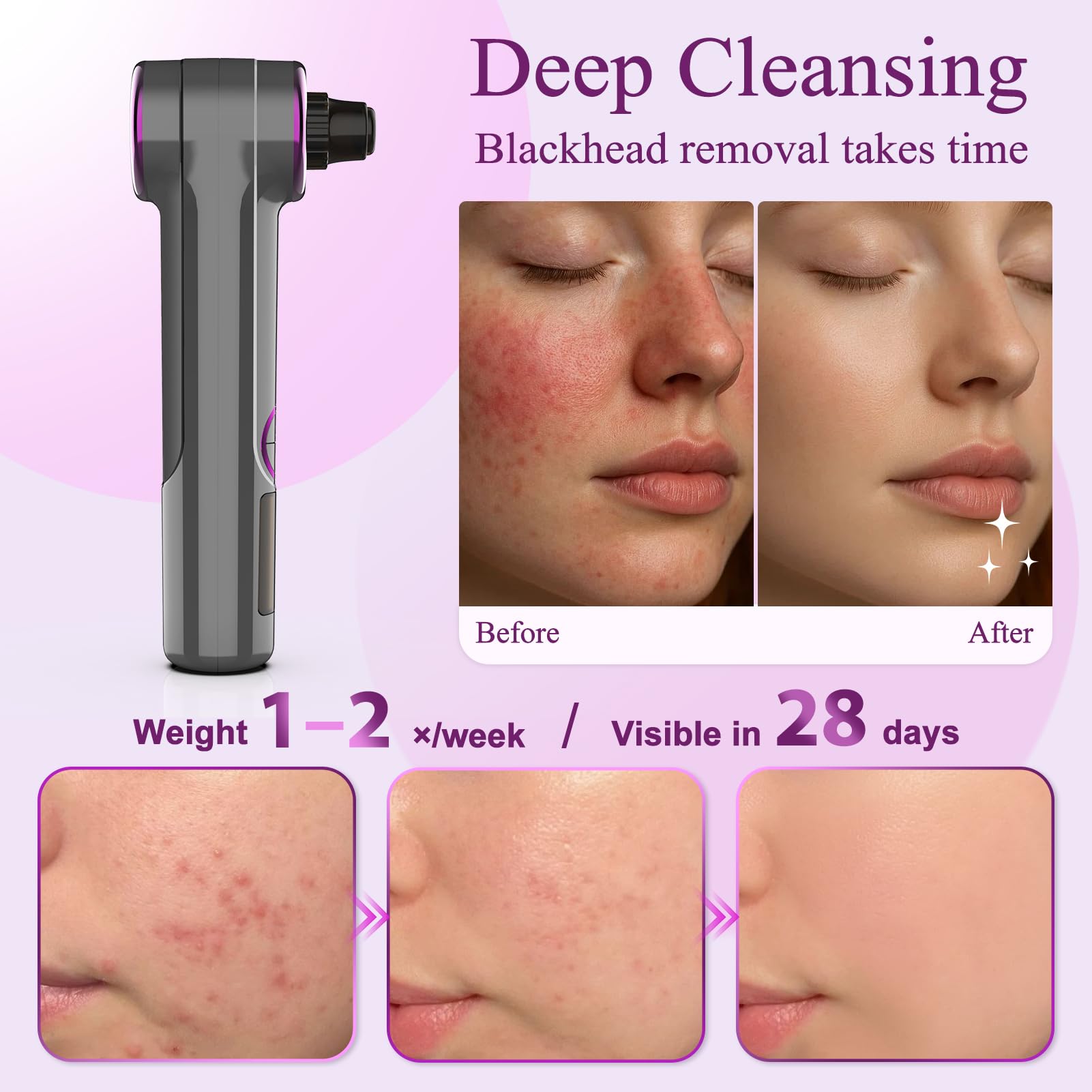 Rinycwa detachable heads make hygiene and cleaning simple after use.