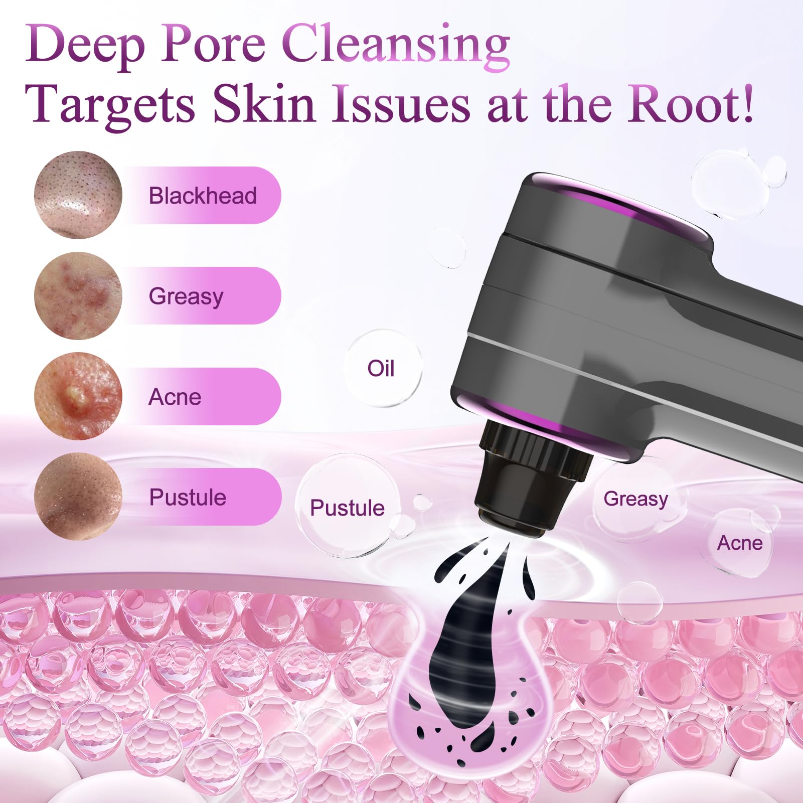 Rinycwa head small for nose precision pore cleansing and oil control.