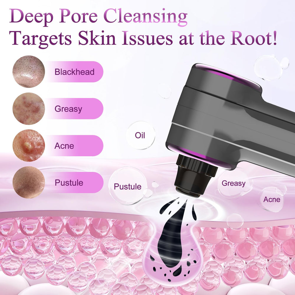 Rinycwa head small for nose precision pore cleansing and oil control.