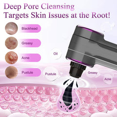 Rinycwa head small for nose precision pore cleansing and oil control.