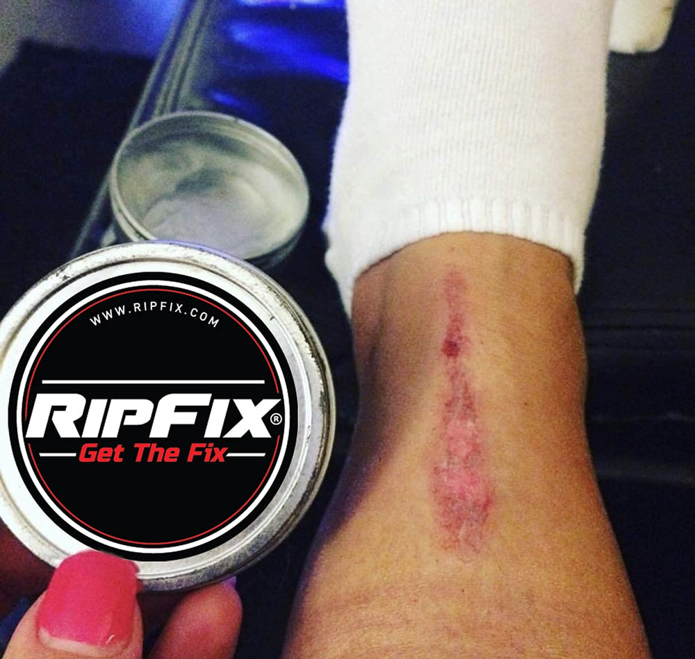RipFix gymnast/climber application on hands demonstrates durable protection during training.