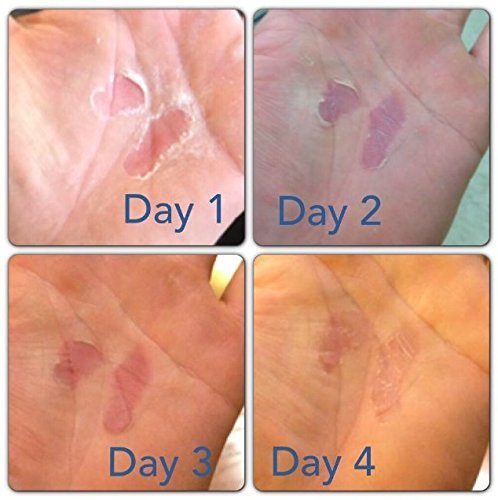 RipFix night-use on skin shows overnight care can support recovery.