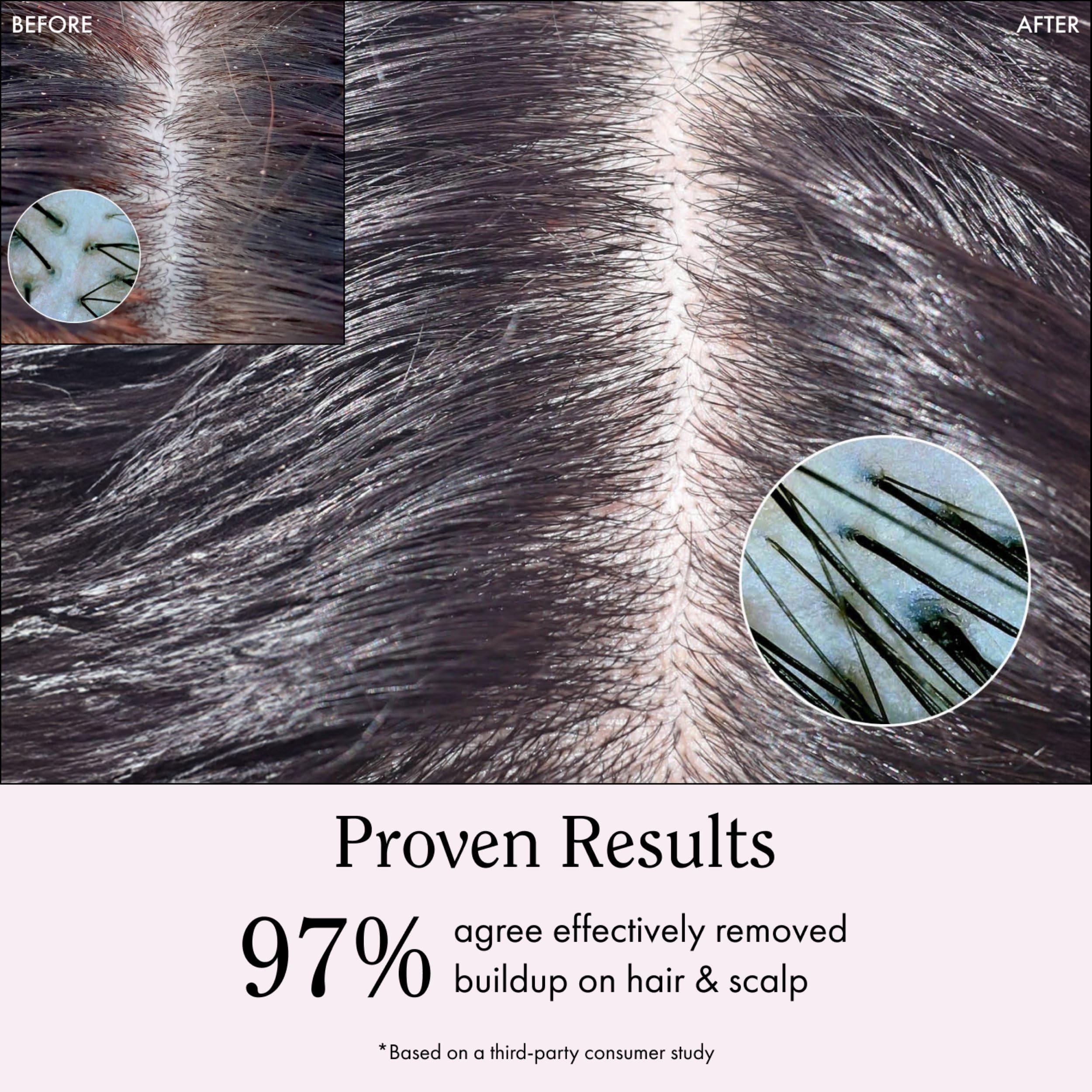 Rizos Curls scalp massage application shows soothing wash routine.