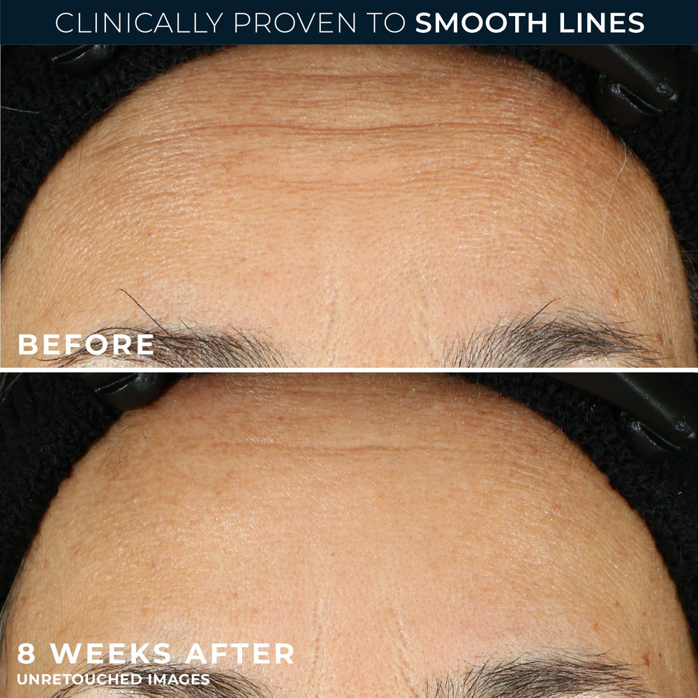 RoC Retinol Correxion capsule texture suggests silky overnight care