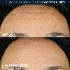 RoC Retinol Correxion capsule texture suggests silky overnight care