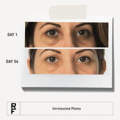 RODAN + FIELDS Bright Eye Complex suitable for all skin types with gentle formula
