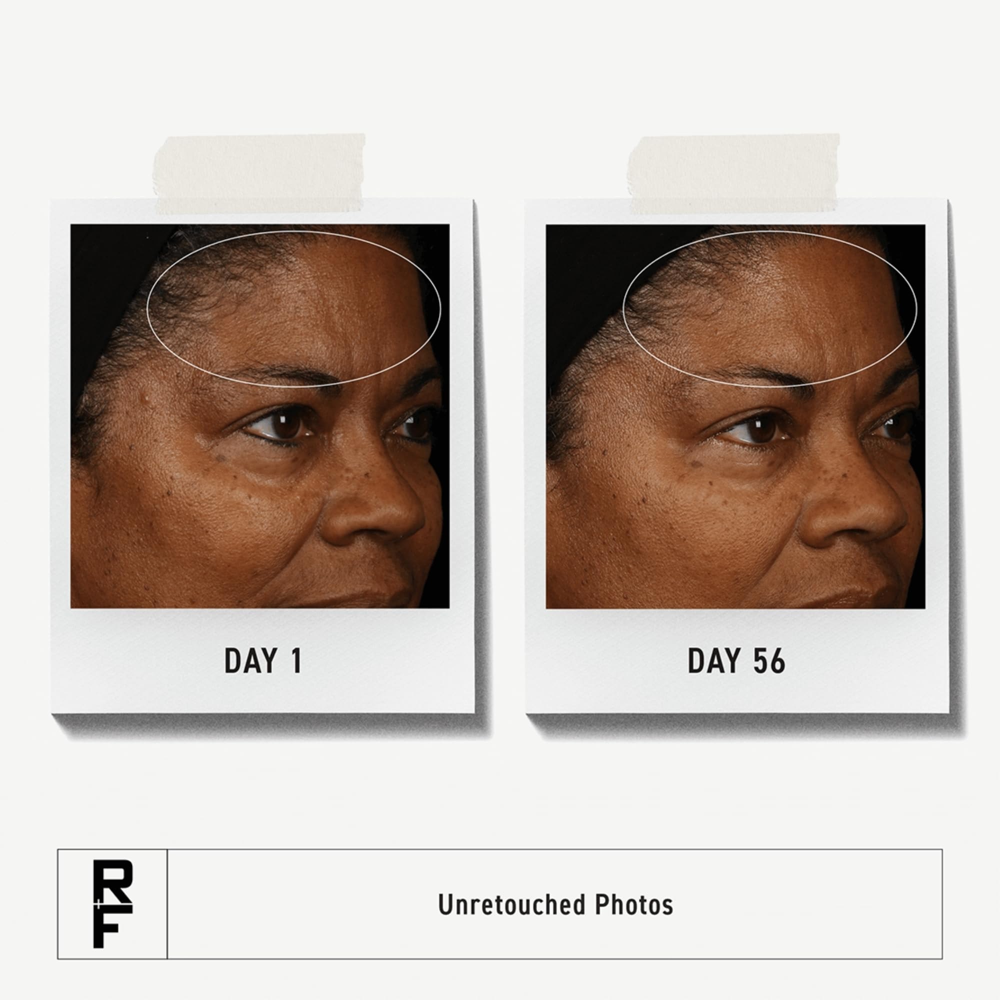 Rodan + Fields ReDefine clay cleanser texture closeup highlights pore refinement.