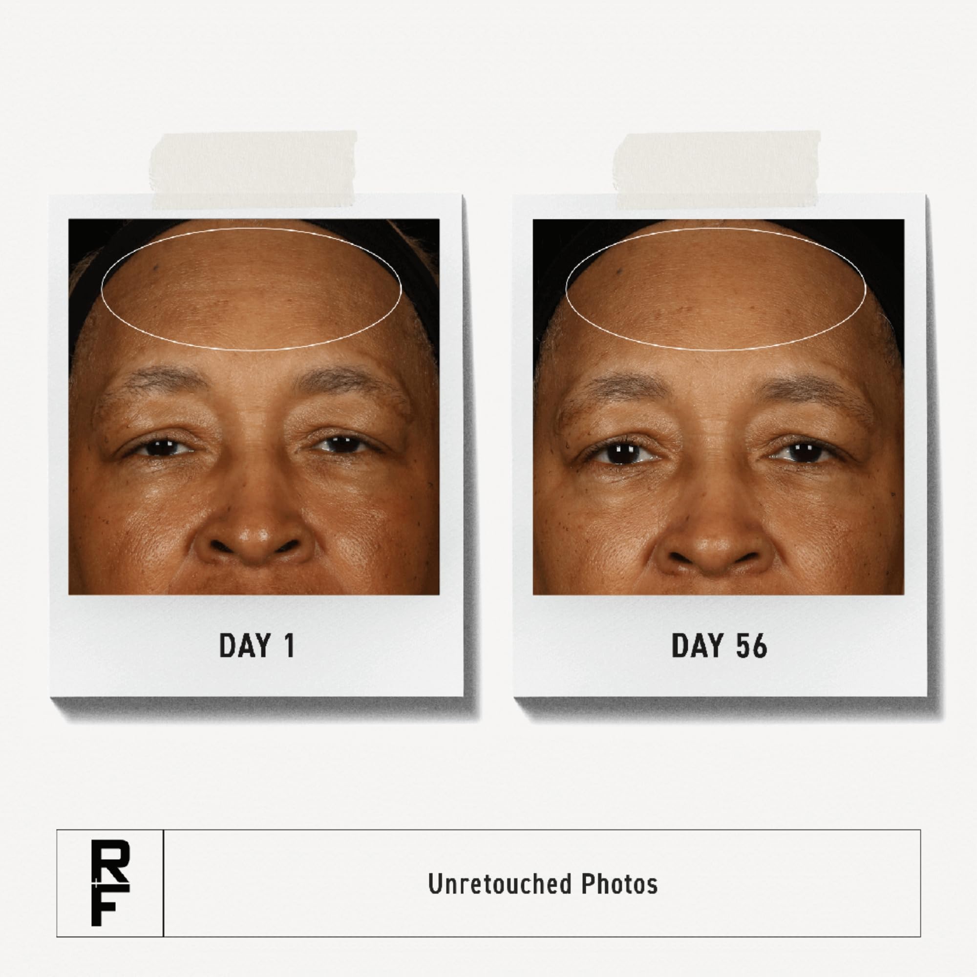 RODAN + FIELDS Redefine application on dry skin demonstrates overnight hydration.