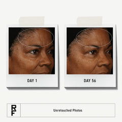 Rodan + Fields redefine toner bottle ready for pore refinement.