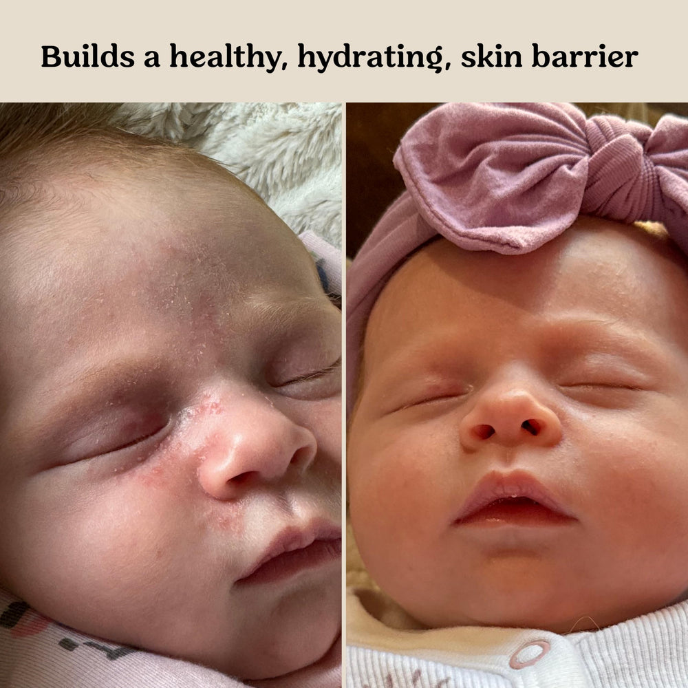 Roe Wellness baby serum ingredients list highlighting probiotic formula.