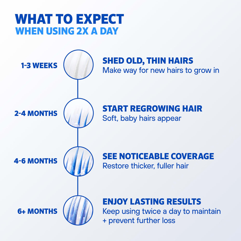 Rogaine foam being massaged into scalp demonstrates simple daily application