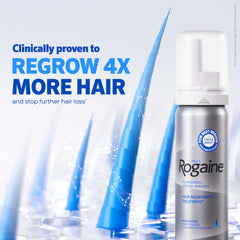 Rogaine Men's Foam applied to vertex thinning area supports potential regrowth