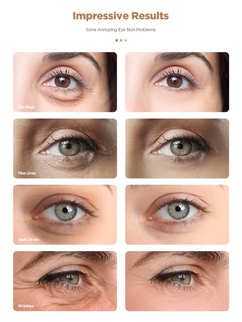 Rokelos eye patches with hyaluronic acid for hydrated under-eye skin