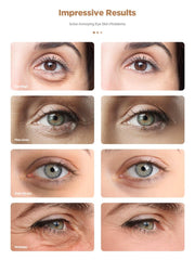 Rokelos eye patches with hyaluronic acid for hydrated under-eye skin