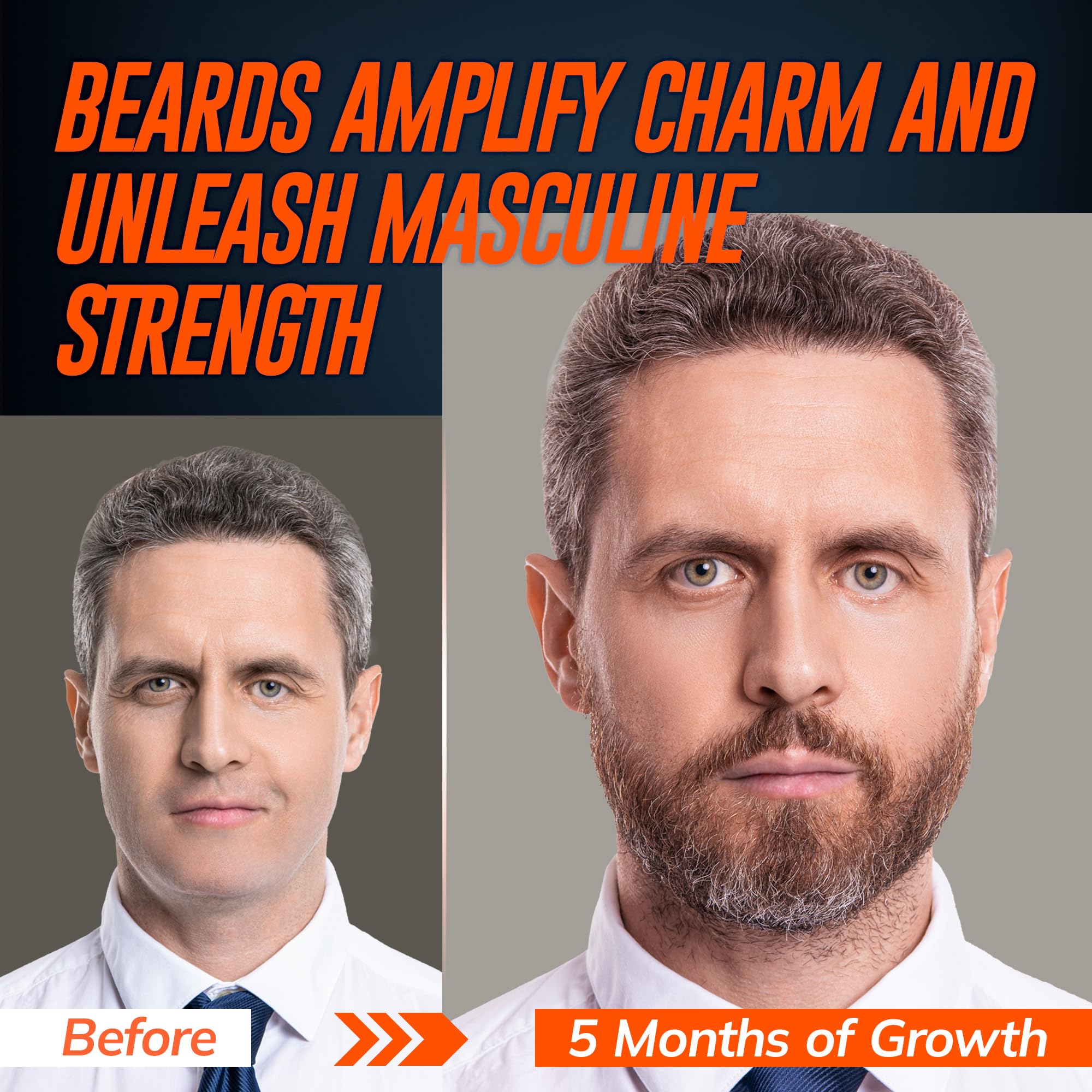 RootStim minoxidil beard serum bottle beside glass with glossy new growth potential.