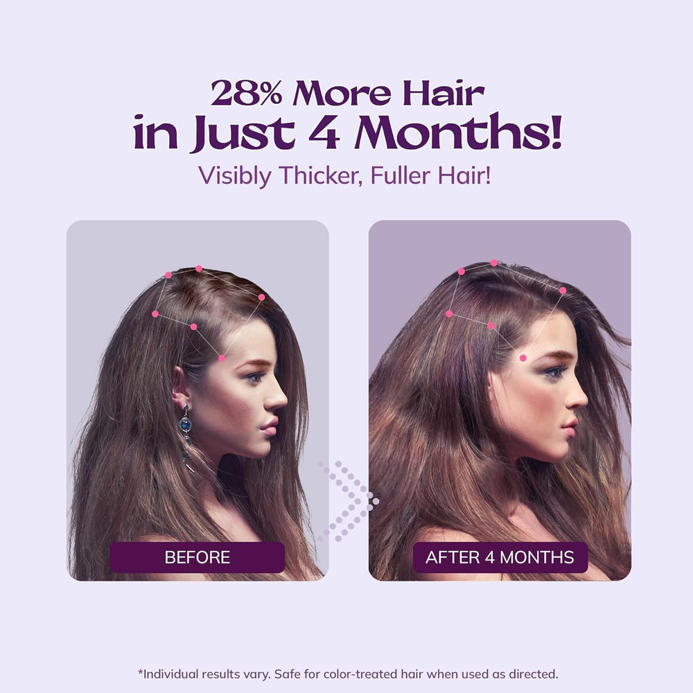 RootStim rosemary biotin scalp nourishment supports healthier looking hair