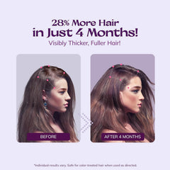 RootStim rosemary biotin scalp nourishment supports healthier looking hair