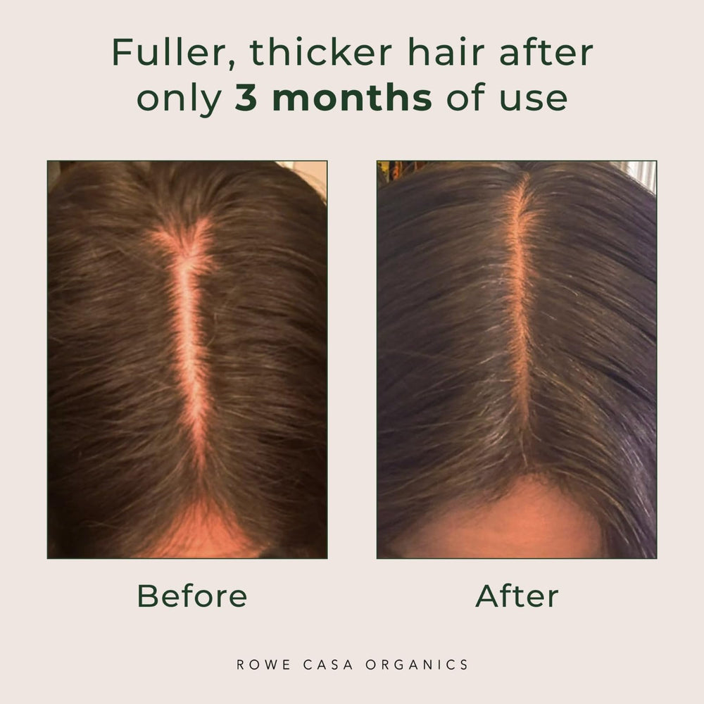 Rowe Casa Organics tea tree element hints at clarifying scalp benefits