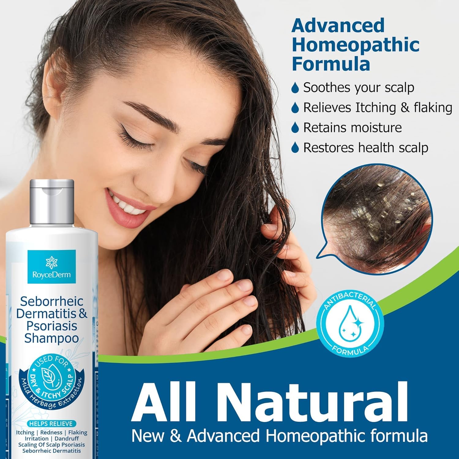 Roycederm psoriasis shampoo lather close-up for gentle cleansing