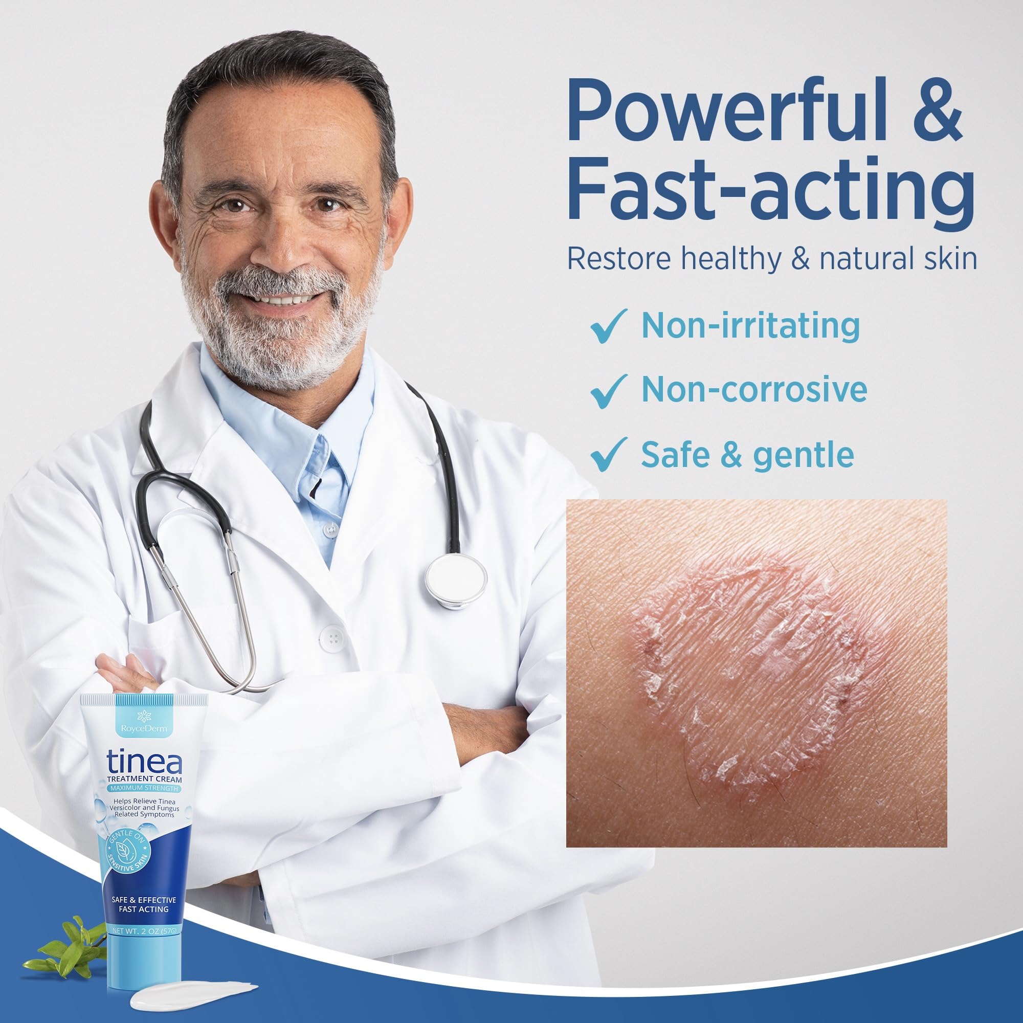 Roycederm-ringworm-treatment-cream-label highlights gentle herbal extracts supporting skin comfort and relief of symptoms.
