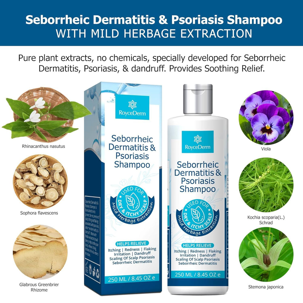 Roycederm seborrheic dermatitis shampoo application on scalp for relief