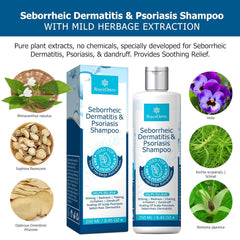 Roycederm seborrheic dermatitis shampoo application on scalp for relief