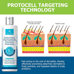Roycederm seborrheic dermatitis shampoo rinse scene for easy use