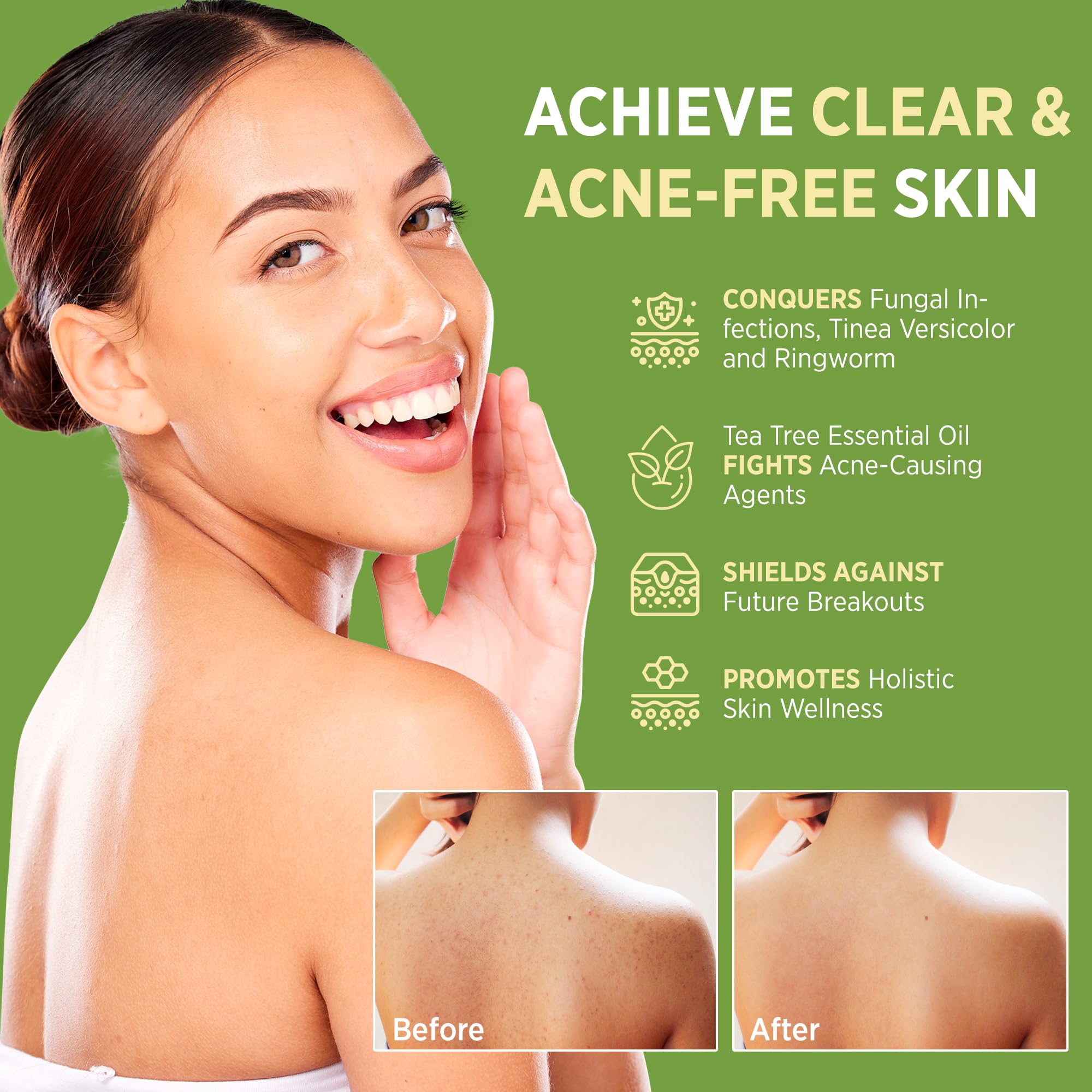 Roycederm tea tree soap hands applying for skin purification