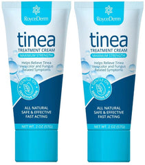 Roycederm tinea-versicolor-treatment bottle demonstrates targeted fungal skin care for common discoloration and may help soothe itching.