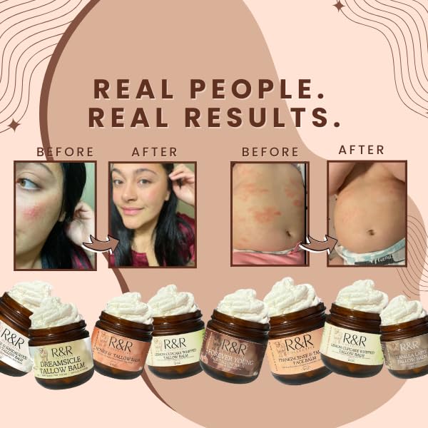 R&R Collective Frankincense Tallow Face Moisturizer forearm application demonstrating gentle soothing