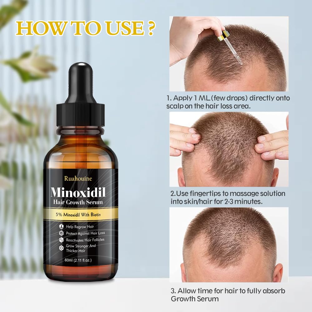 Ruahouine man applying minoxidil on scalp with gentle massage.