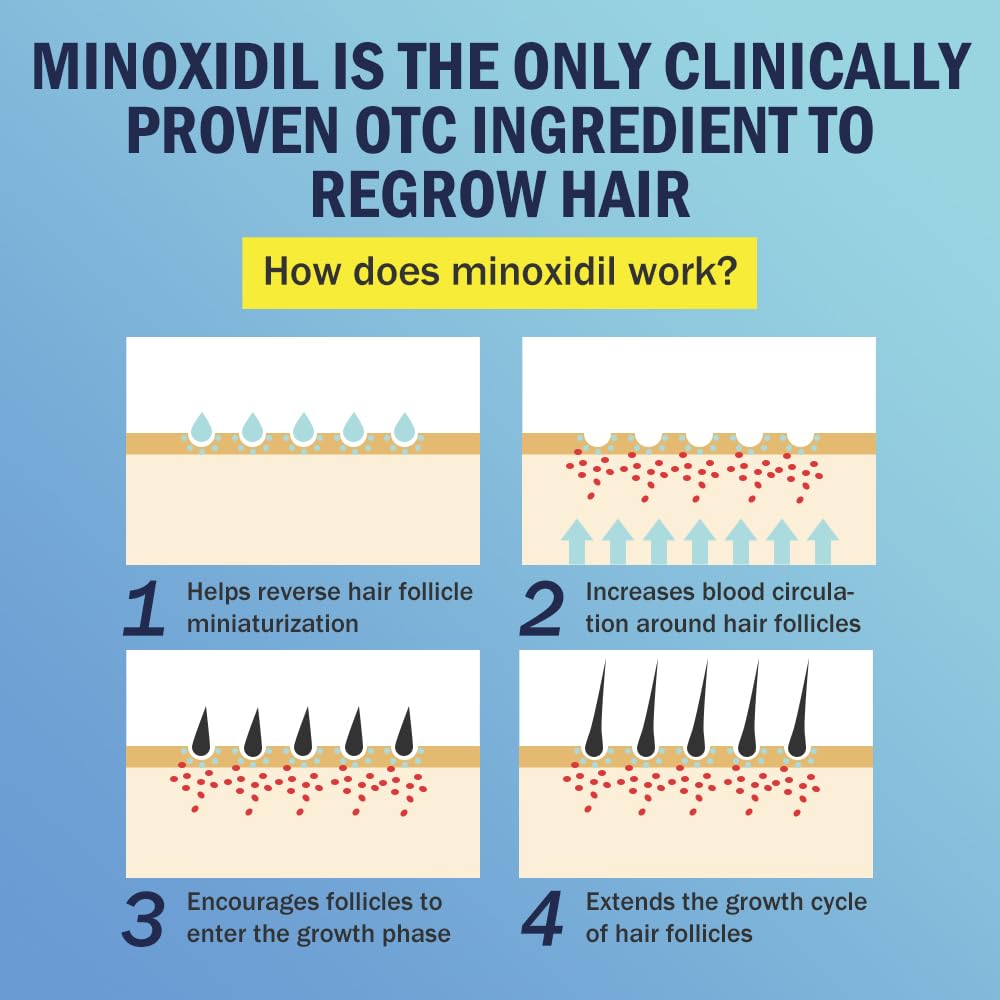 Ruahouine Minoxidil Foam three-bottle packaging for a three-month supply.