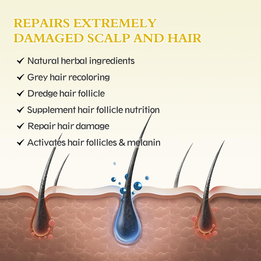 Ruahouine woman applying minoxidil on scalp during daily routine.