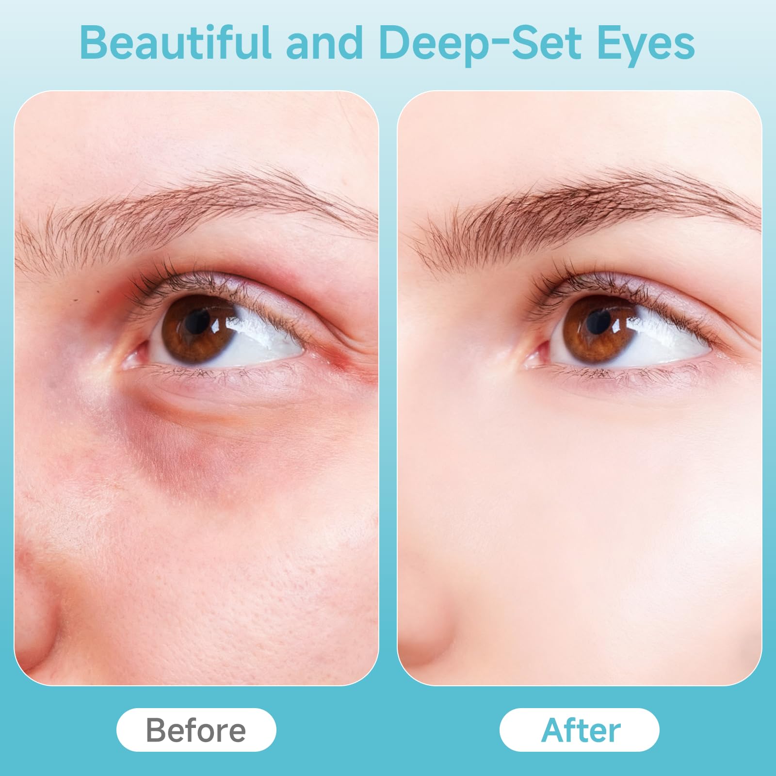 Ructmou Eye Care Wand compact design fits easy travel skincare rituals.