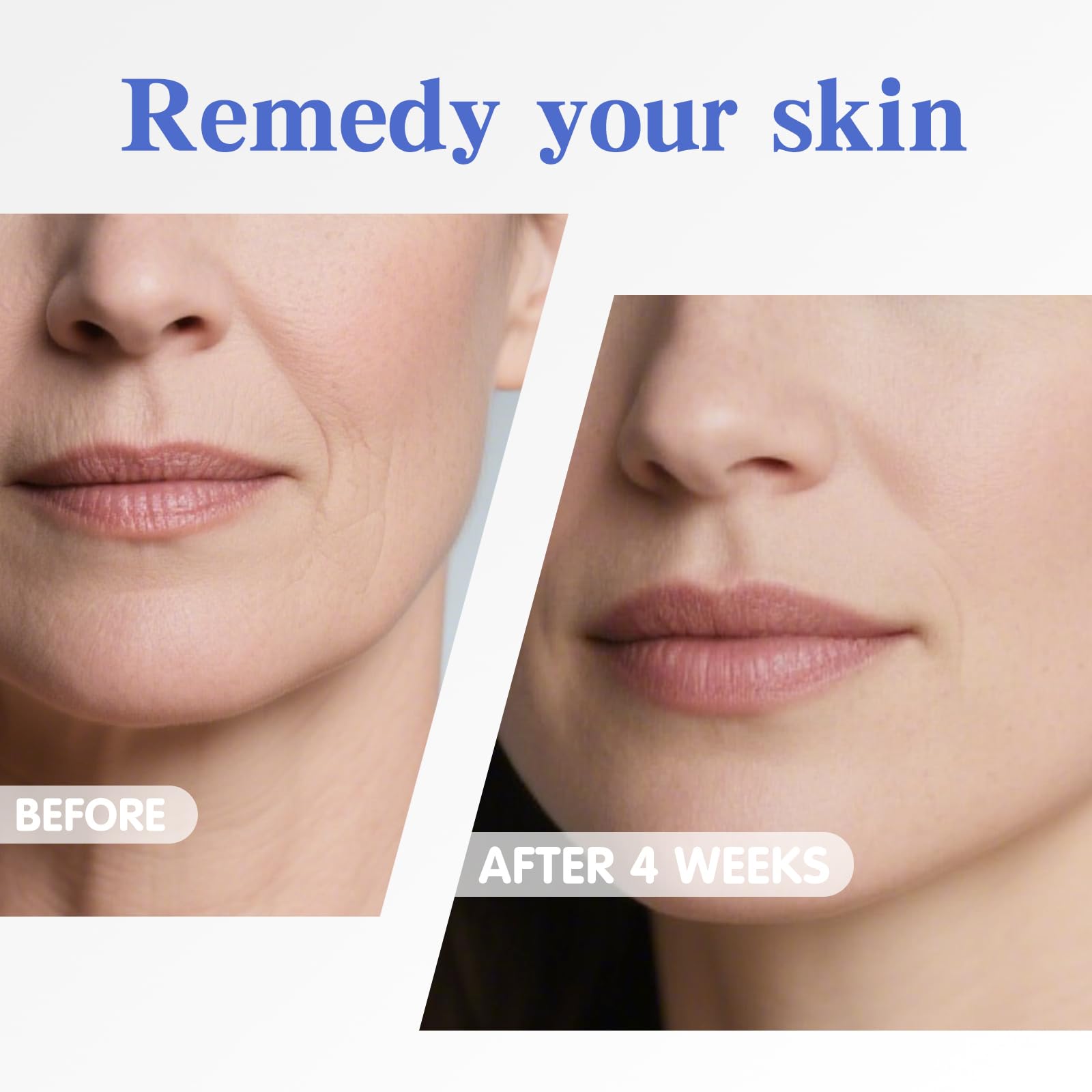 RUICHIGO Elasticity Firming Skin hints at lifting and improved firmness
