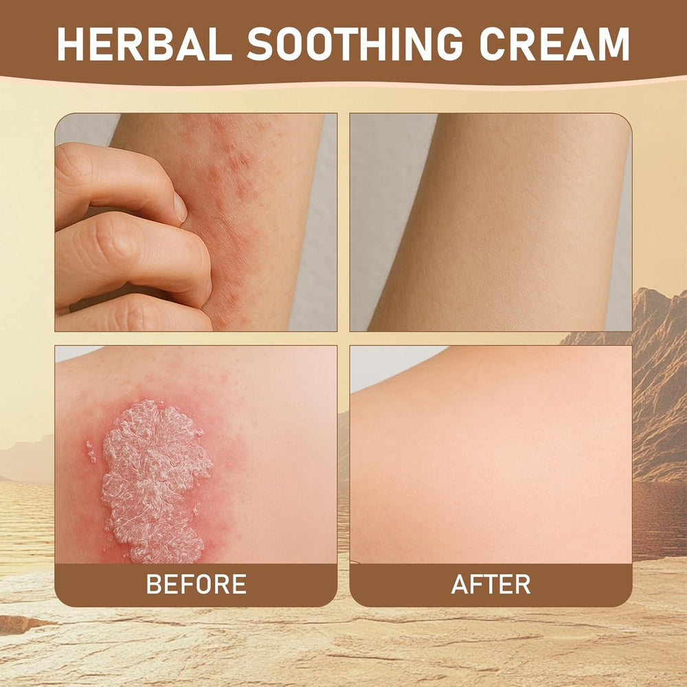 Rulinal Gentle formula packaging illustrating safe care for sensitive skin and family use.