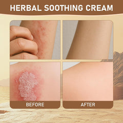 Rulinal Gentle formula packaging illustrating safe care for sensitive skin and family use.
