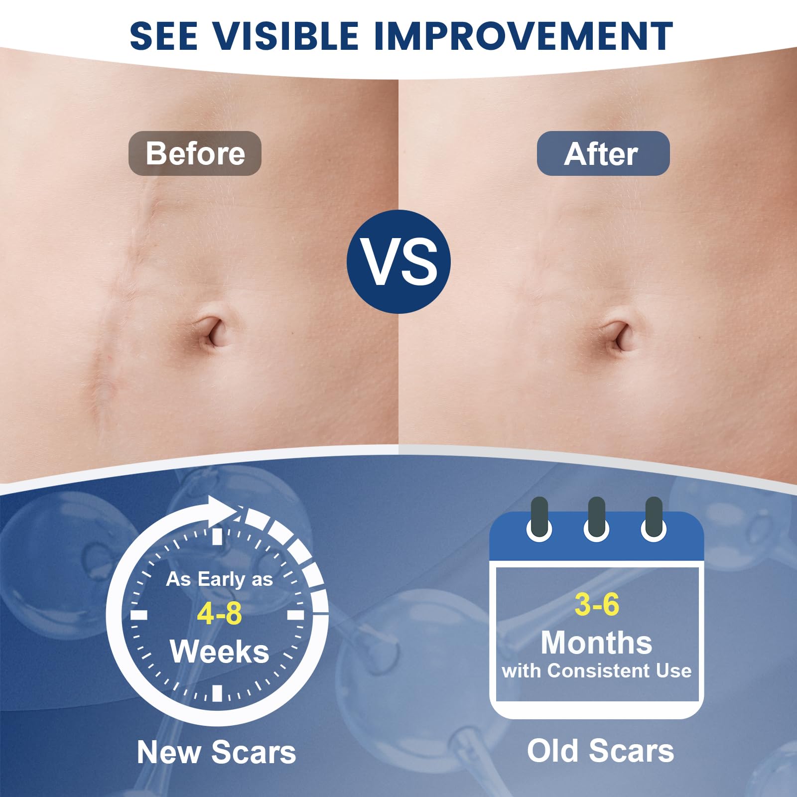 Application of Rvlaim Scar Gel on skin, demonstrating its fast-absorbing qualities.