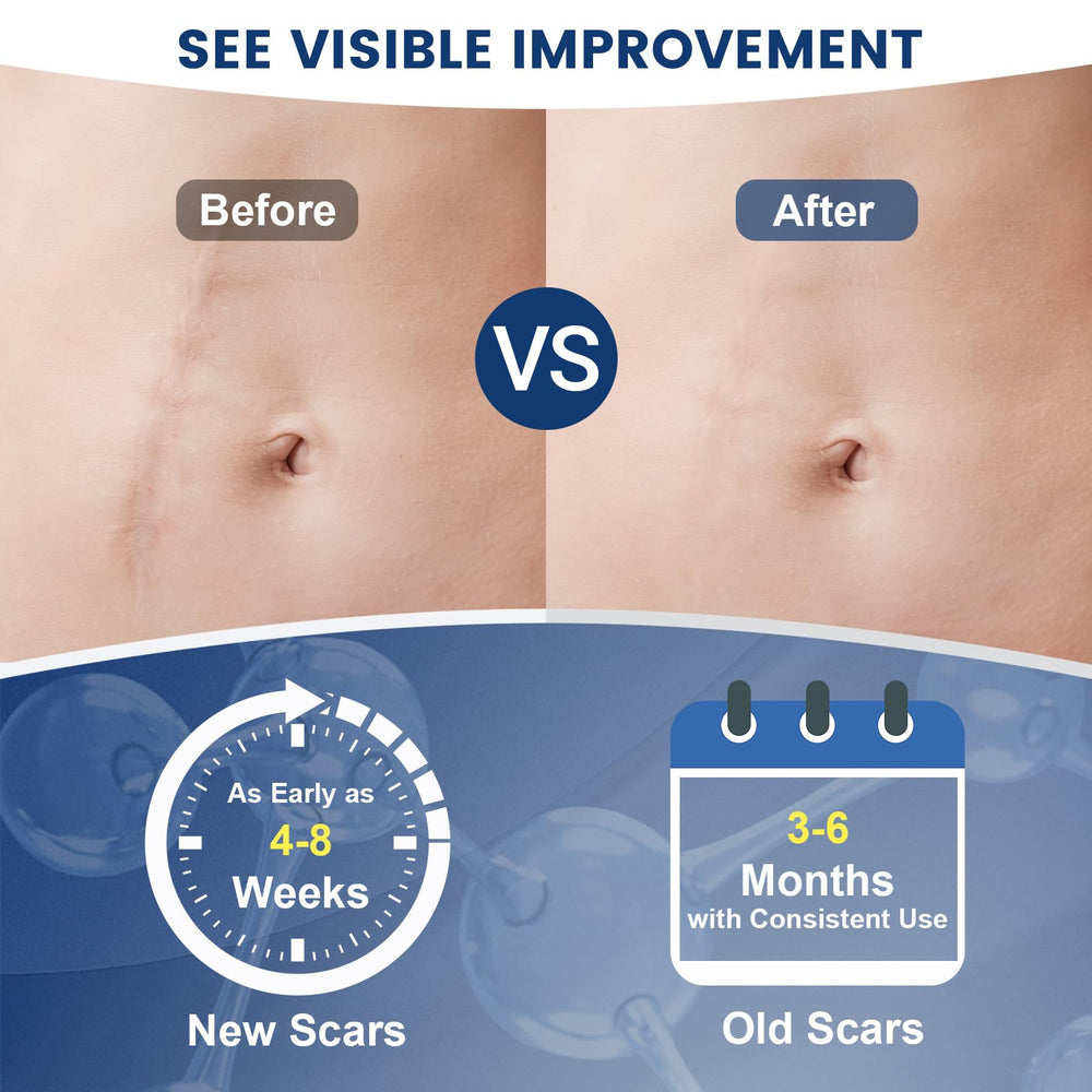 Application of Rvlaim Scar Gel on skin, demonstrating its fast-absorbing qualities.