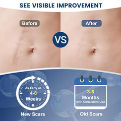 Application of Rvlaim Scar Gel on skin, demonstrating its fast-absorbing qualities.
