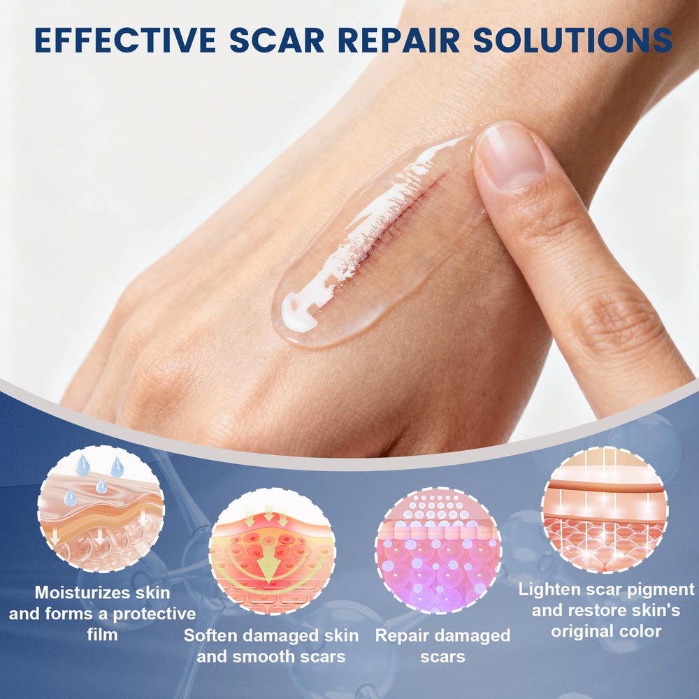 Before and after comparison of Rvlaim Scar Gel's effectiveness on scars.