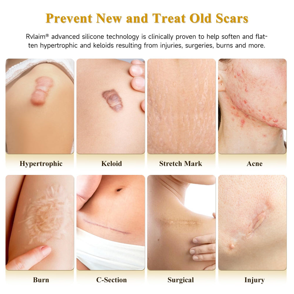 Rvlaim silicone scar cream gel texture closeup highlighting lightweight formula.
