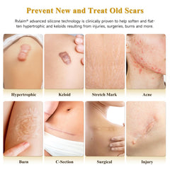 Rvlaim silicone scar cream gel texture closeup highlighting lightweight formula.