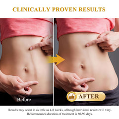 Rvlaim silicone scar cream softens new scar appearance after application.
