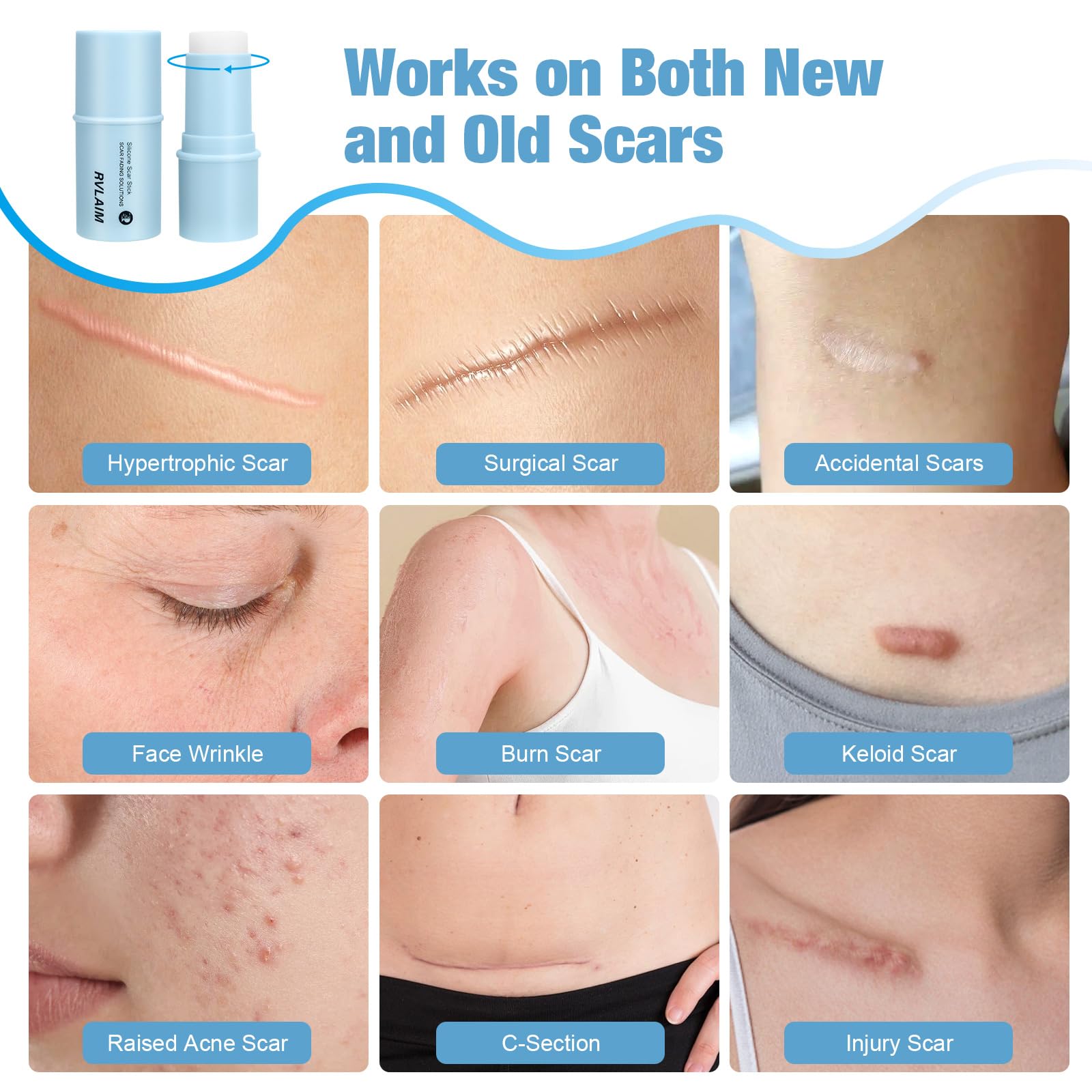 Rvlaim Silicone Scar Stick shown on face and body for scar care.