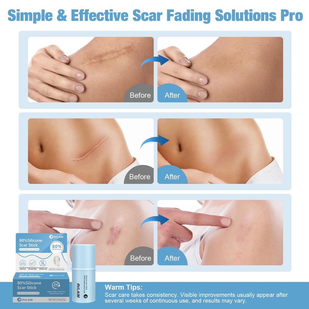 Rvlaim Silicone Scar Stick packaging demonstrates travel-friendly, compact design.