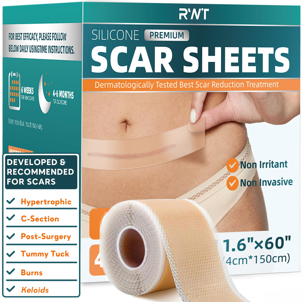 RWT silicone scar roll 60-inch application shows easy trimming for scar coverage