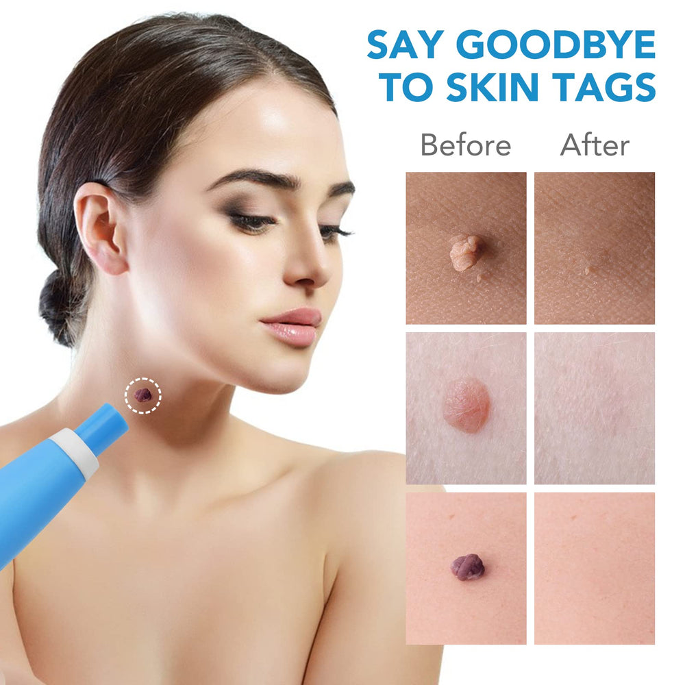 SacXand safety features highlighted for safe, at-home skin care